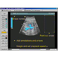 dekom dicom net office viewer ultraschall sonografie